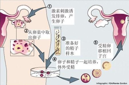 代生试管机构